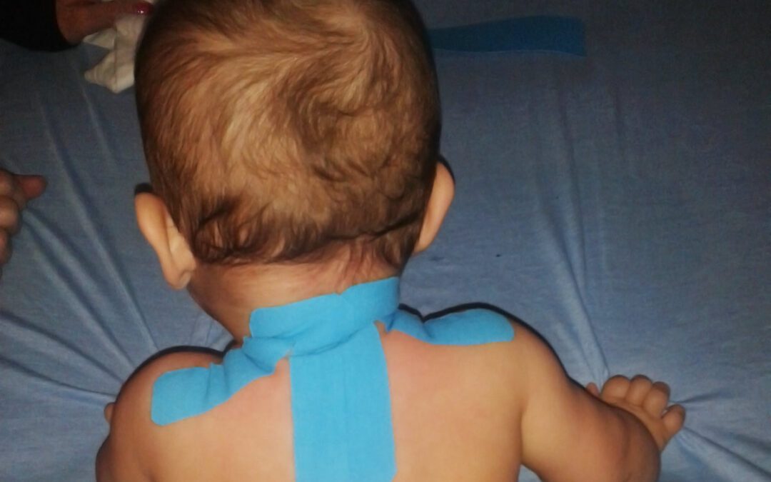 A kinesio tape